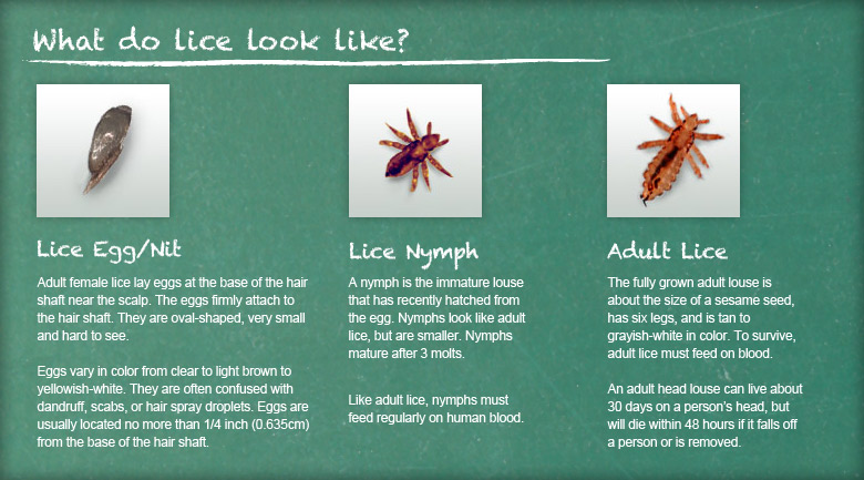 Head Lice – Natural Ginesis