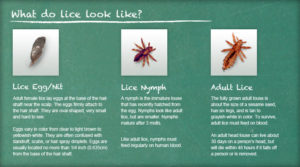 Ladibugs Lice Treatment Center | Lice Treatment Clinic